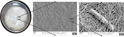 Editorial: Up to date developments of nanocellulose towards materials with medical benefits